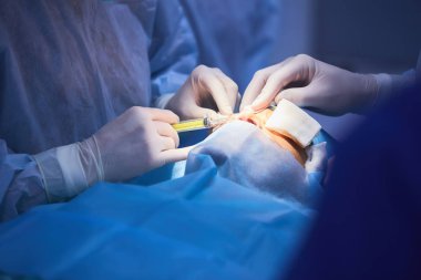 Plastik cerrahi sömürge göz kapağı, Oda, Blefaroplasti.