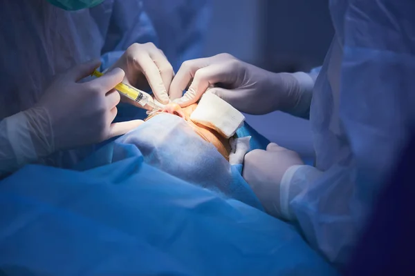 Plastik cerrahi sömürge göz kapağı, Oda, Blefaroplasti.