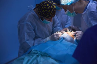 Ameliyat ekibi modern işlemi tiyatro, birlikte bir cerrahi ameliyathane sırasında çalışan hekimlerin bir ameliyat sırasında bir hastanın konsantre hekimlerin ameliyat