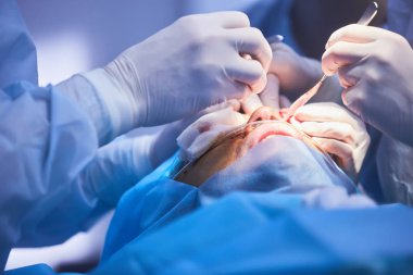 Blefaroplasti, plastik cerrahi operasyon kusurları, deformiteleri ve göz kapakları disfigurations düzeltmek ve estetik yüz göz bölgesini değiştirmek için. tıbbi klinikte
