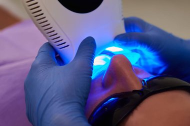 Klinikteki dişçide çalışan bir kadının yakın plan portresi. Diş dolgusu ultraviyole lamba. Sığ dof.