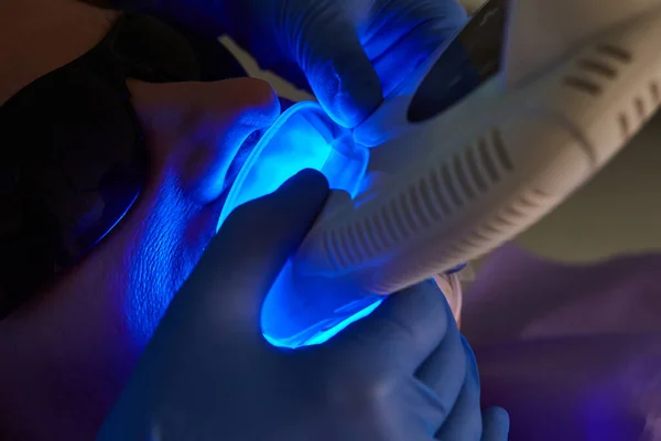 Retrato de perto de uma paciente do sexo feminino no dentista na clínica. Dentes branqueamento procedimento com luz ultravioleta lâmpada UV. Dof rasa — Fotografia de Stock