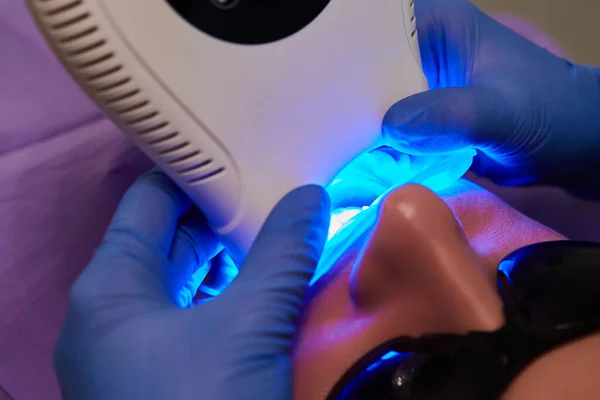 Retrato de perto de uma paciente do sexo feminino no dentista na clínica. Lâmpada ultravioleta de enchimento de dentes. Dof rasa. — Fotografia de Stock
