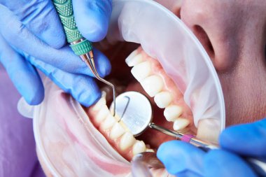 Makro, balta ve ağız aynasıyla insan dişlerini kapat. Sığ dof.