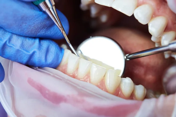 Primer plano de la mujer abriendo la boca durante la inspección de la cavidad oral. Dof poco profundo — Foto de Stock