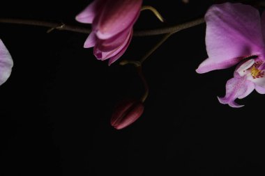 siyah zemin pembe orkide