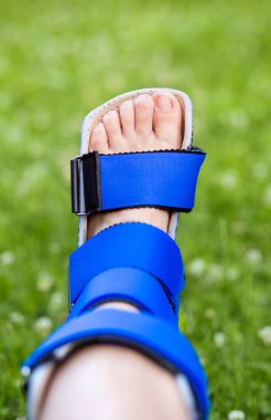 Ayak bileği iyileşmesi, spor kazasından sonra destek desteğiyle dengeleniyor.