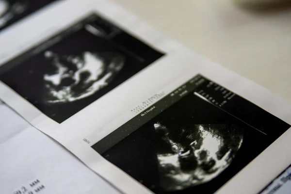 Heart ultrasound image print on paper