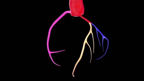 Барвисті Зображення Cta Coronary Army Рендеринга Або Коронарне Дерево Ілюстрації — стокове фото