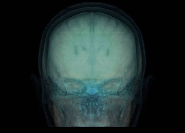 Прозоре Зображення Черепа Мозком Медичної Концепції Фону — стокове фото