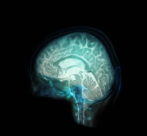 Прозоре Зображення Бічного Синього Кольору Черепа Мозком Медичної Концепції Фону — стокове фото