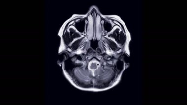 Eksensel T2W Görünümünde MRI beyin veya manyetik rezonans görüntüleme.