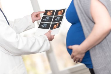Doktor gösteren bebek ultrason görüntüsü hamile kadına