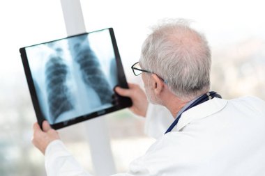 Kıdemli doktor röntgen bakıyor