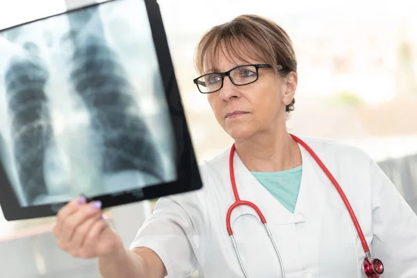 Medico femminile che guarda i raggi X — Foto Stock