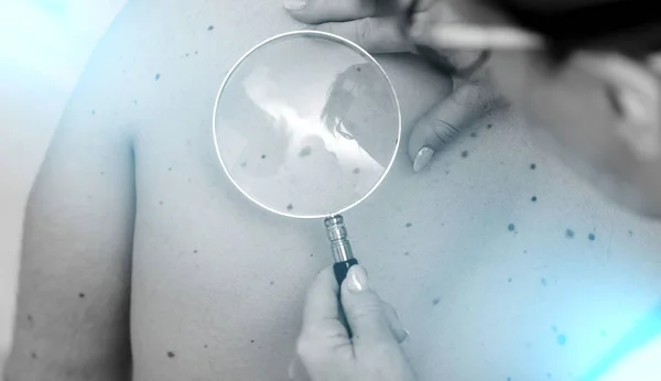 Dermatólogo examinando la piel de un paciente; efecto de luz — Foto de Stock