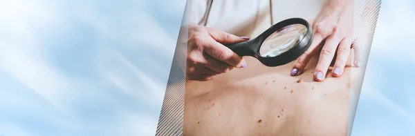 Dermatoloog die de huid van een patiënt onderzoekt; panoramische banner — Stockfoto