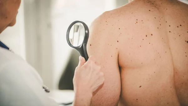 Dermatologe Untersucht Die Haut Arm Eines Patienten — Stockfoto