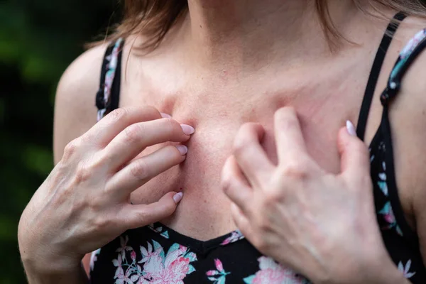 身体发痒 胸部发痒的女人 — 图库照片