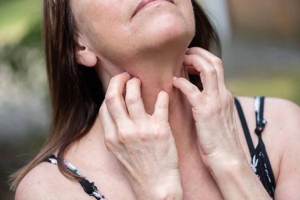 Wanita Yang Gatal Dan Menggaruk Lehernya — Stok Foto