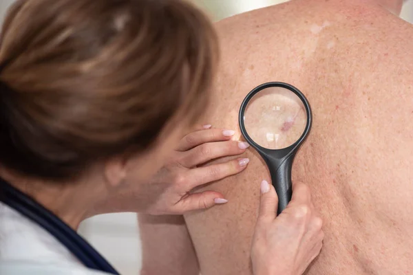 Dermatolog Vyšetřující Kůži Zádech Pacienta — Stock fotografie