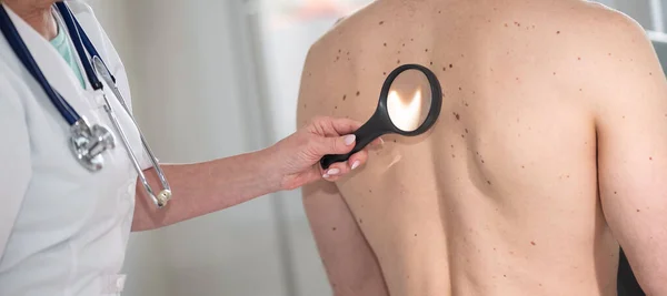 Dermatologe Untersucht Die Haut Rücken Eines Patienten — Stockfoto