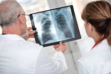 Röntgen raporunu muayene eden iki doktor.