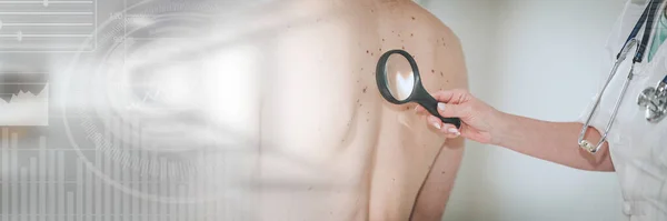 Dermatologe Untersucht Die Haut Auf Dem Rücken Eines Patienten Panorama — Stockfoto