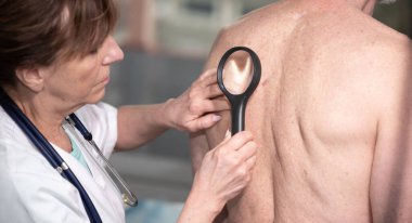 Dermatolog bir hastanın sırtındaki deriyi inceliyor.