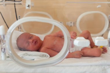 Hastanede prematüre yeni doğmuş bebek. Yenidoğan yoğun bakım ünitesi 