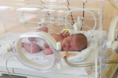 Hastanede prematüre yeni doğmuş bebek. Yenidoğan yoğun bakım ünitesi 