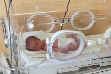 Hastanede prematüre yeni doğmuş bebek. Yenidoğan yoğun bakım ünitesi 
