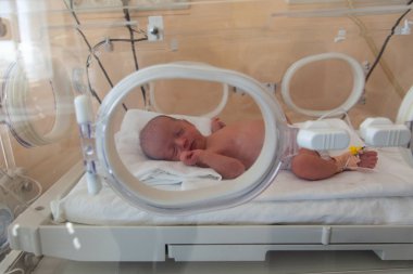 Hastanede prematüre yeni doğmuş bebek. Yenidoğan yoğun bakım ünitesi 