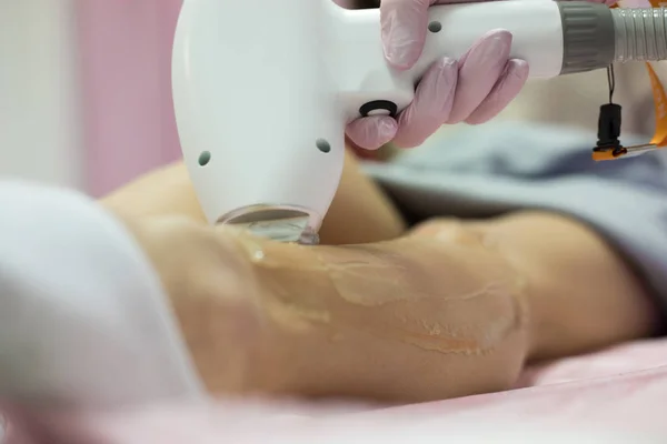 Epilazione laser e cosmetologia. Procedura di depilazione laser cosmetologia . — Foto Stock