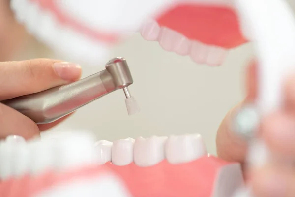 Una recepción en el consultorio del dentista, limpiando el esmalte de los dientes —  Fotos de Stock