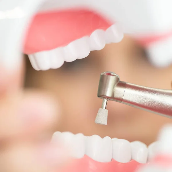 Una recepción en el consultorio del dentista, limpiando el esmalte de los dientes —  Fotos de Stock