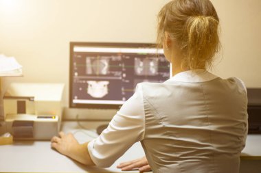 bir doktor kadın bir diş kliniğinde çene ve dişlerin monitör hacimsel resmi bakar