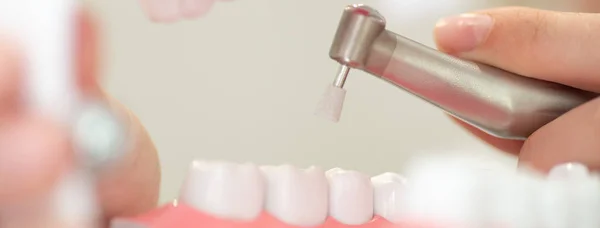 Una recepción en el consultorio del dentista, limpiando el esmalte de los dientes —  Fotos de Stock