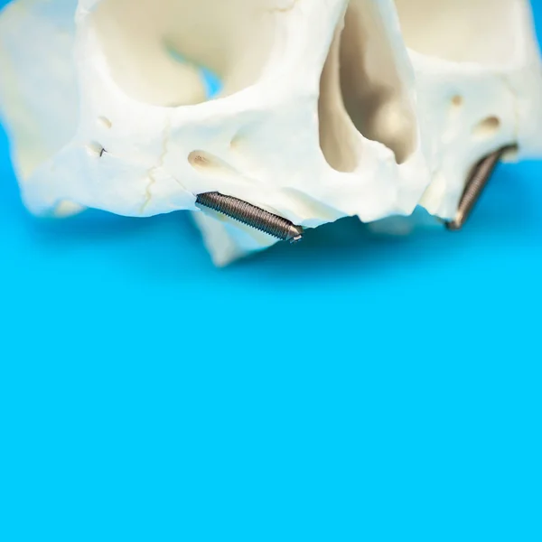 Ιατρικό μοτίβο κρανίο με ψεύτικες καρφίτσες δοντιών σε μπλε φόντο — Φωτογραφία Αρχείου