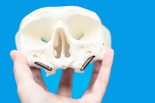 Medicinsk kraniemønster med falske tænder pins på blå baggrund - Stock-foto
