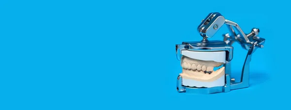 Mandíbula fundida en un dispositivo médico especial sobre fondo azul —  Fotos de Stock