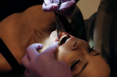 Bu resim, bir diş tedavisinin yakından ve ayrıntılı bir görüntüsünü sağlar, hastanın açıkça tedavi gördüğünü gösterir