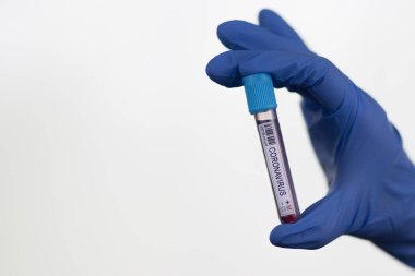 2020 'de dünya salgınında yapılan koronavirüs testinin kan örneği. Laboratuvar asistanı covid-19 testi için kan örneği tutuyor..
