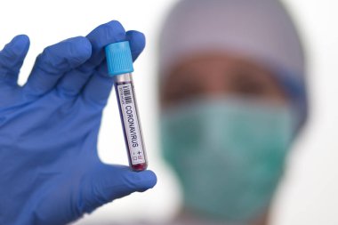 2020 'de dünya salgınında yapılan koronavirüs testinin kan örneği. Laboratuvar asistanı covid-19 testi için kan örneği tutuyor..
