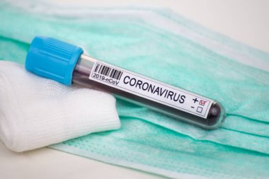 2020 'de dünya salgınında yapılan koronavirüs testinin kan örneği. Laboratuvar asistanı covid-19 testi için kan örneği tutuyor..