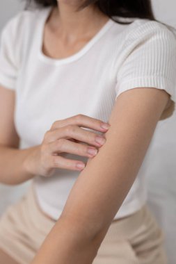 Kolunu parmaklarıyla kaşıyan kadınların yakın çekimi kaşındığını ya da tahriş olduğunu gösteriyor. Cilt alerjisi, kuru cilt ya da kişisel sağlık hizmetleriyle ilgili dermatolojik sorunlar kavramı.