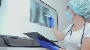 Genç bir doktor akciğerlerin fotoğrafını silecek. Zatürree veya tüberküloz teşhisi. Hastanın röntgen incelemesi. Önleme, akciğer kanseri, zatürree ve tüberküloz