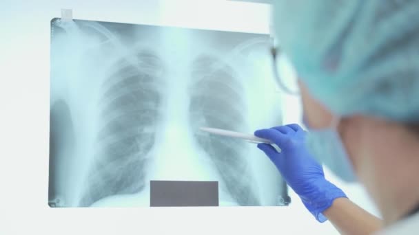 Ένας Νεαρός Γιατρός Σβήσει Ένα Στιγμιότυπο Των Πνευμόνων Διάγνωση Πνευμονίας — Αρχείο Βίντεο