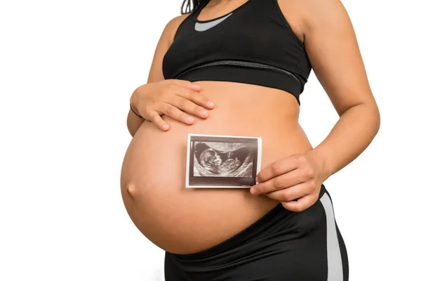 Großaufnahme Einer Schwangeren Frau Die Das Bild Des Ultraschallbildes Des — Stockfoto