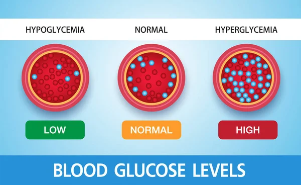 Hiperglicemia Elevado Açúcar Sangue Diabetes Obesidade Uma Condição Médica Grave — Vetor de Stock